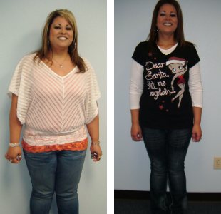 Before and after weight loss pictures of a smiling woman