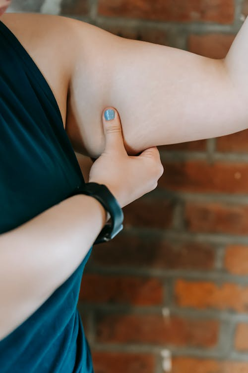 An image of a woman touching her bicep